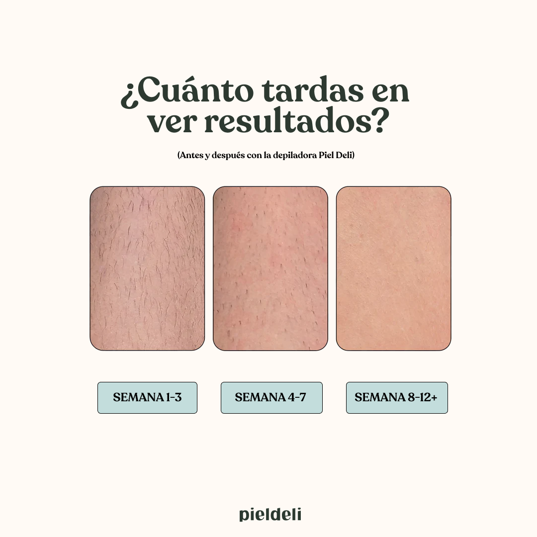 Depiladora IPL Clásica + Gel Conductor de regalo